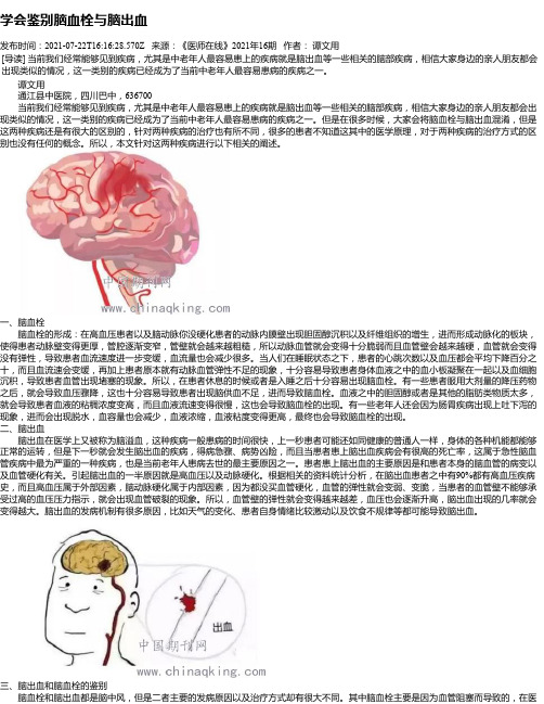 学会鉴别脑血栓与脑出血