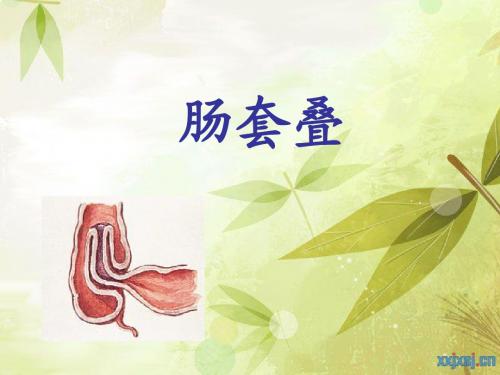 吴静雅-肠套叠