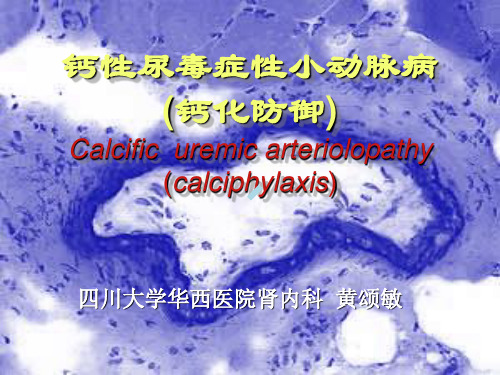 血液透析与钙性尿毒症性小动脉病(修改稿)