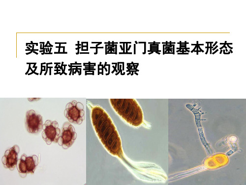 普通植物病理学实验实验五 植物病原菌物5