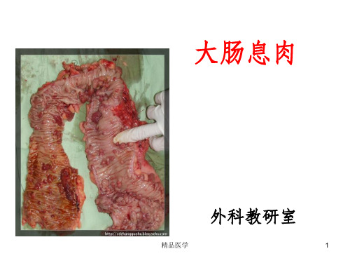 《大肠息肉》PPT课件