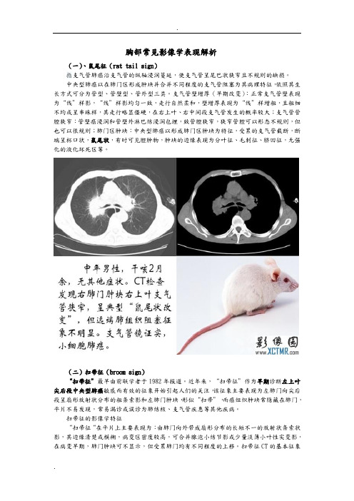 常见胸部影像学征象解析