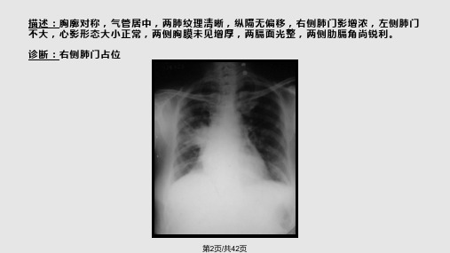 常见X片读片及诊断课件