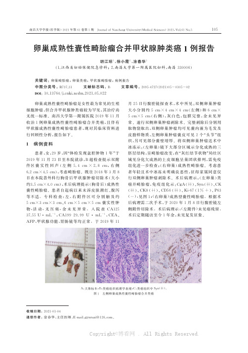 卵巢成熟性囊性畸胎瘤合并甲状腺肿类癌1例报告