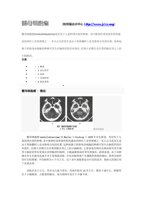 髓母细胞瘤