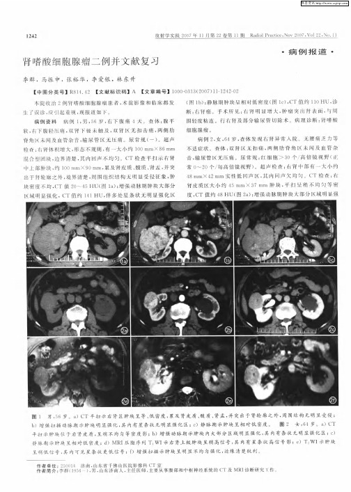 肾嗜酸细胞腺瘤二例并文献复习