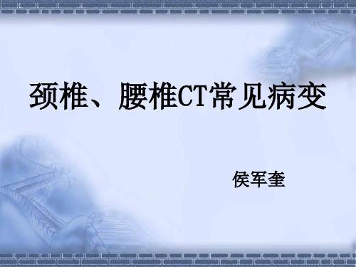 颈椎、腰椎CT常见病变