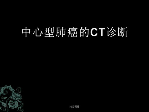 中心型肺癌的CT诊断(全面)