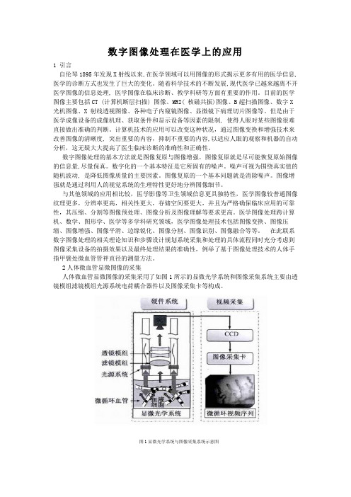 数字图像处理在医学上的应用