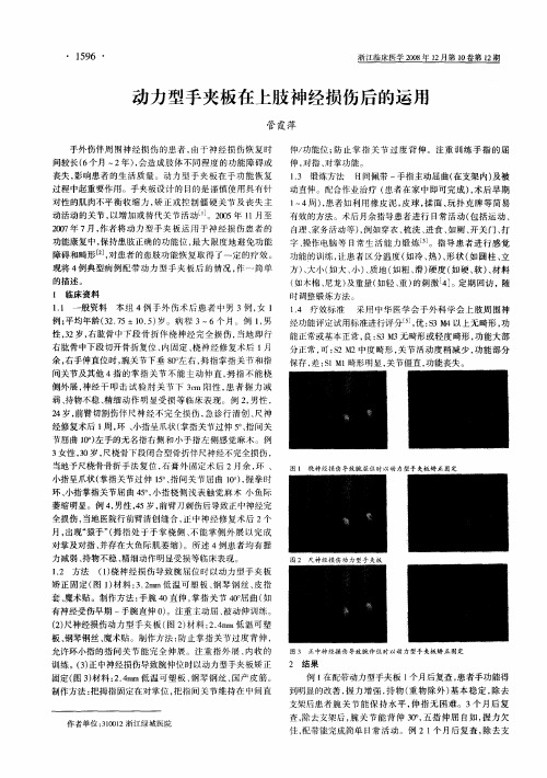 动力型手夹板在上肢神经损伤后的运用