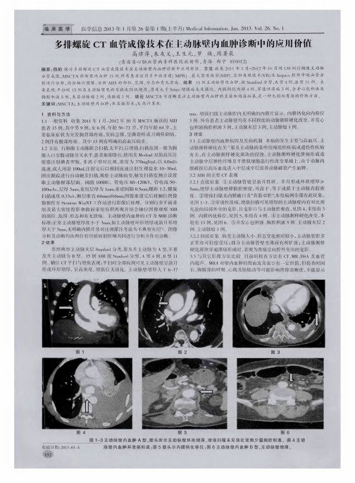 多排螺旋CT血管成像技术在主动脉壁内血肿诊断中的应用价值