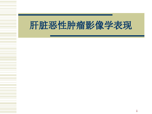 肝脏恶性肿瘤影像学表现PPT课件