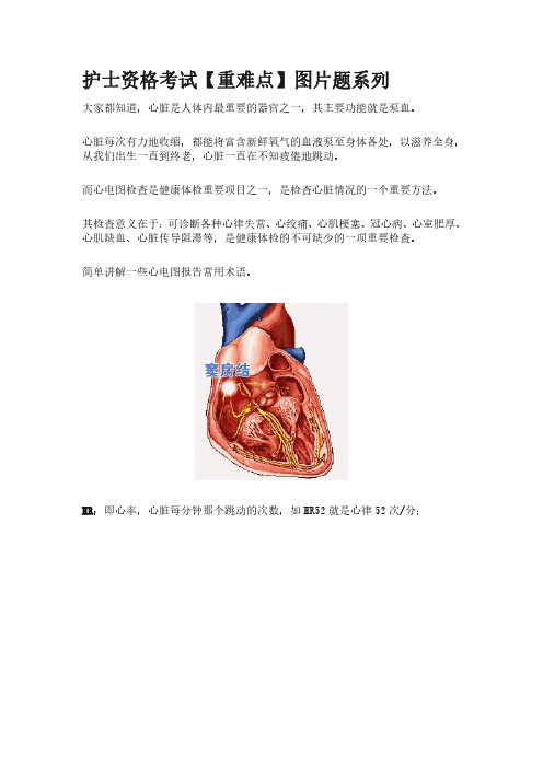 心电图报告常用术语