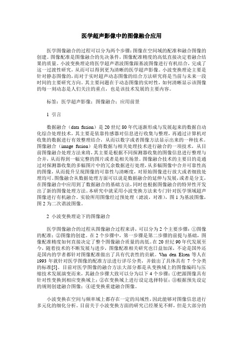 医学超声影像中的图像融合应用