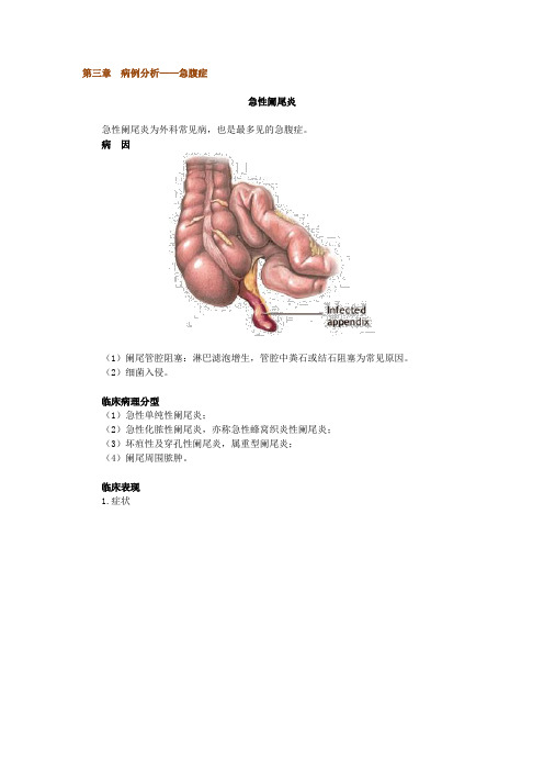 第三章 病例分析——急腹症