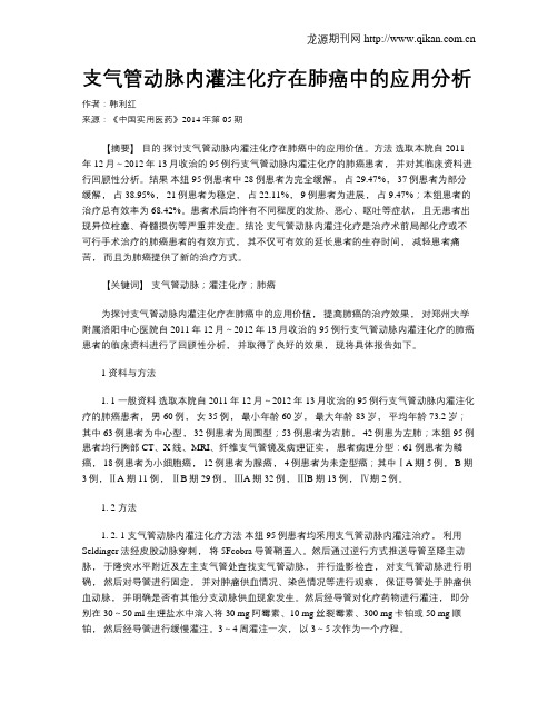 支气管动脉内灌注化疗在肺癌中的应用分析