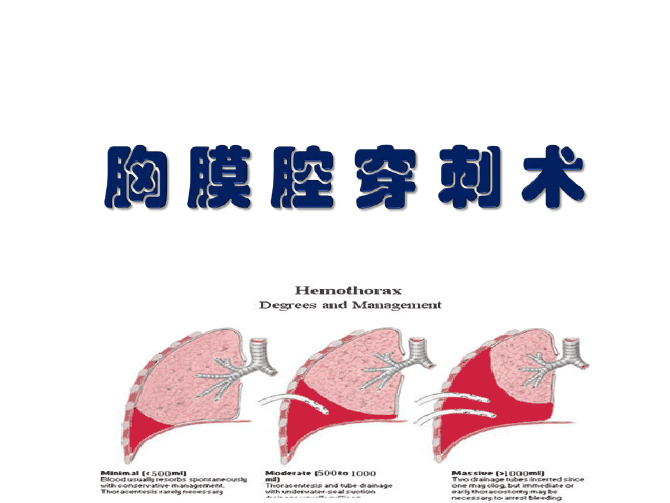 胸膜腔解剖示意图