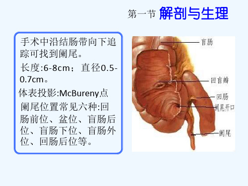 第36章 阑尾炎