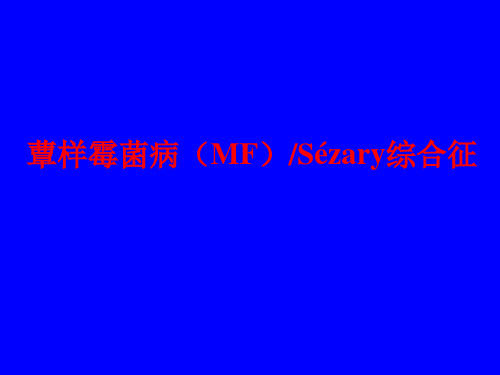 蕈样霉菌病(MF)Szary综合征