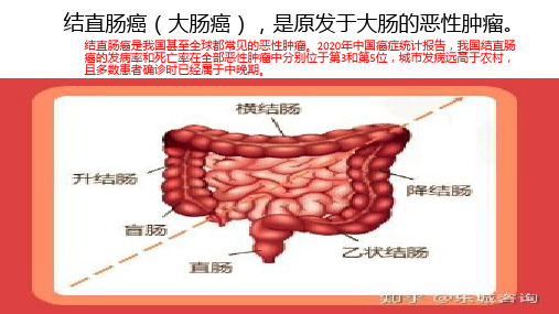 大肠癌PPT