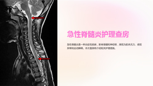 急性脊髓炎护理查房