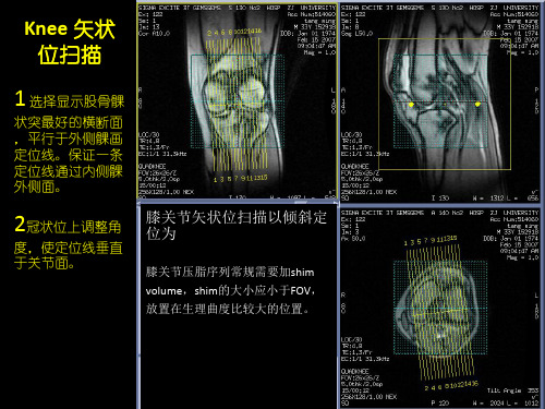 GE15T磁共振操作指南-定位线示例骨关节