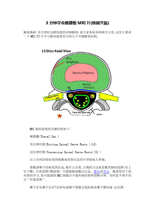 3分钟学会看腰椎MRI片