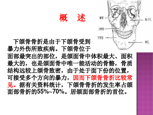 下颌骨骨折教学课件