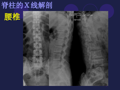 腰椎影像解剖学ppt课件