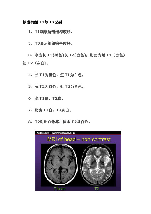 T1与T2区别