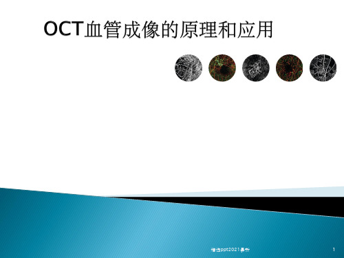 OCT血管成像的原理和应用PPT课件