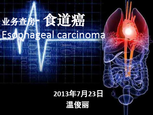 食管癌个案护理查房