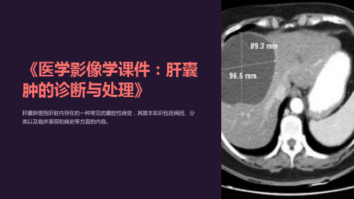 《医学影像学课件：肝囊肿的诊断与处理》