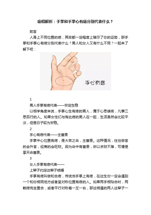 痣相解析：手掌和手掌心有痣分别代表什么？