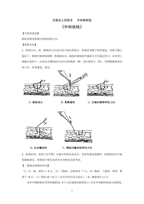 外科缝合伤口拆线