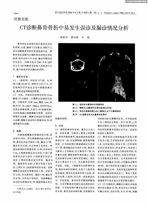 CT诊断鼻骨骨折中易发生误诊及漏诊情况分析