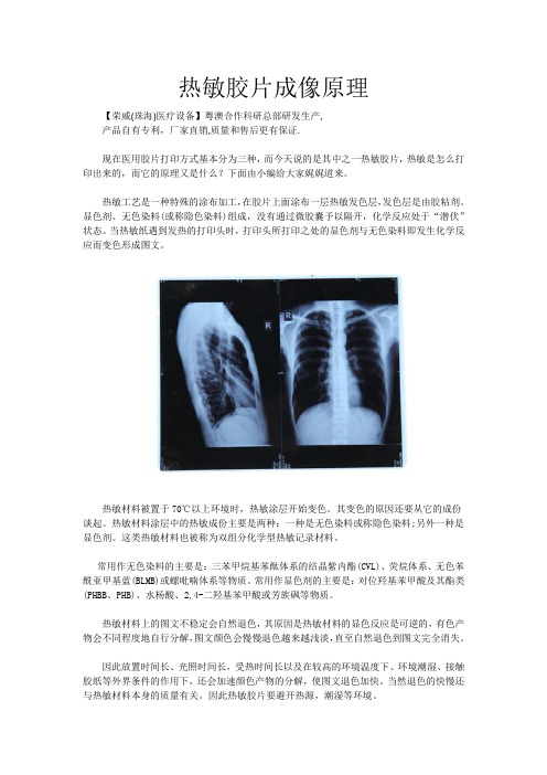 热敏胶片成像原理