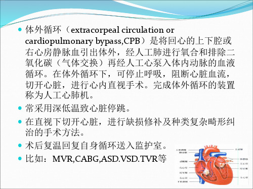 体外循环护理讲课件
