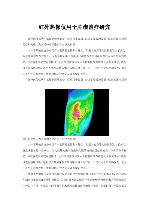 红外热像仪用于肿瘤治疗研究