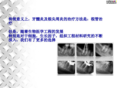 牙髓血运重建术ppt课件-58页精选文档