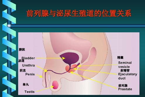 前列腺癌的诊断和治疗【39页】