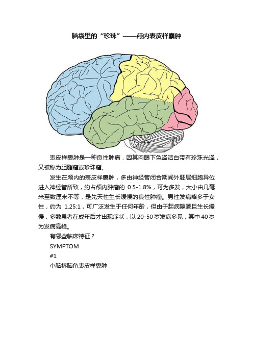 脑袋里的“珍珠”——颅内表皮样囊肿