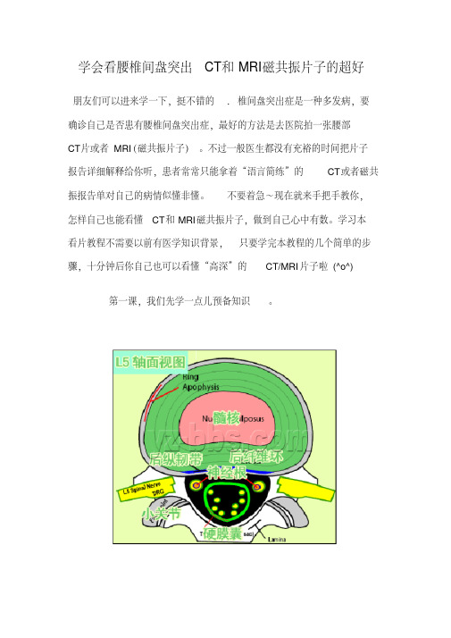 学会看腰椎间盘突出CT和MRI磁共振片子的超好.pdf