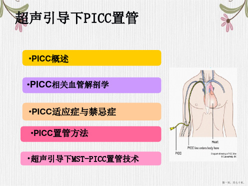 超声引导PICC置管