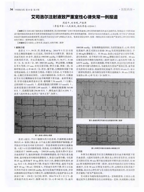 艾司洛尔注射液致严重室性心律失常一例报道