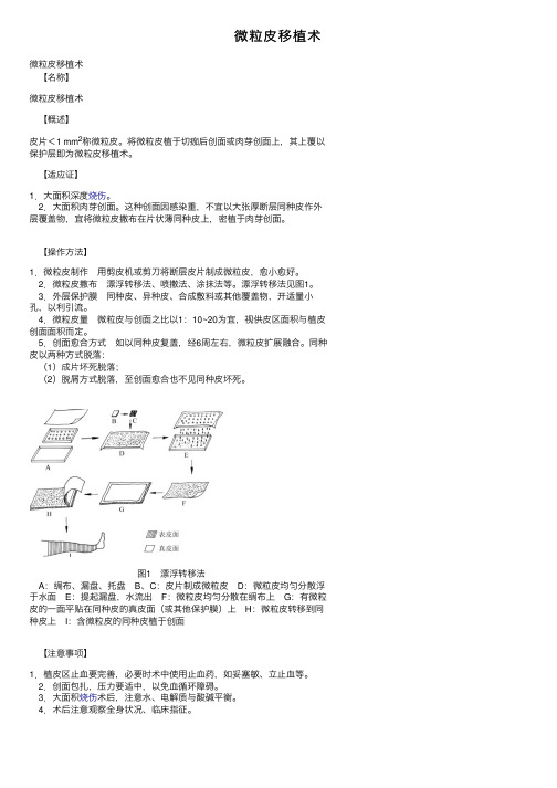 微粒皮移植术