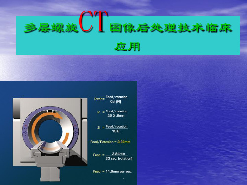 (精品医学)CT图像后处理技术PPT演示课件