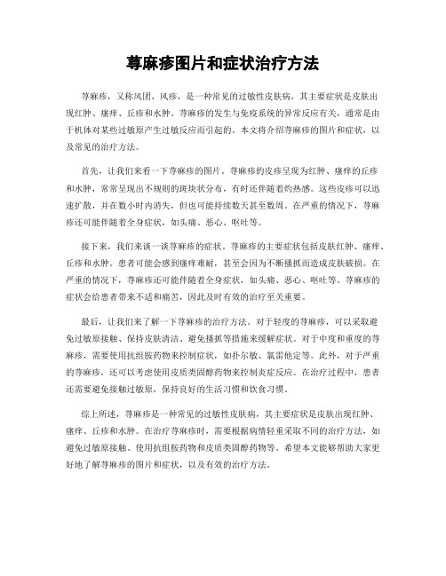 荨麻疹图片和症状治疗方法