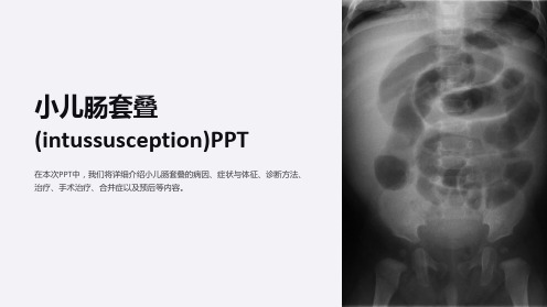 小儿肠套叠(intussusception)PPT