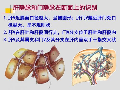 肝胆、门静脉解剖